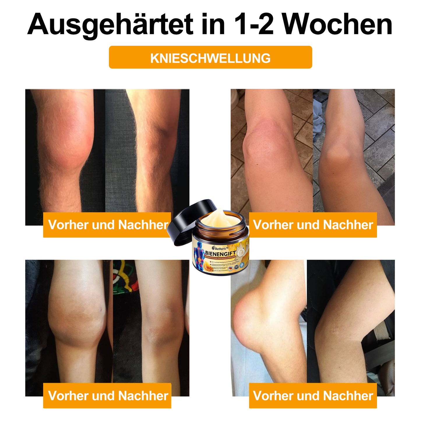 Offizieller Shop: 🔆🔆Aetheris™ Bienengift Sofortige Ultra Starke Schmerztherapie-Creme - (Bietet Schmerzlinderung bei Arthritis, Muskel-, Rücken-, Knie-, Schulter-, Hüft-, Handgelenks- und Handschmerzen)