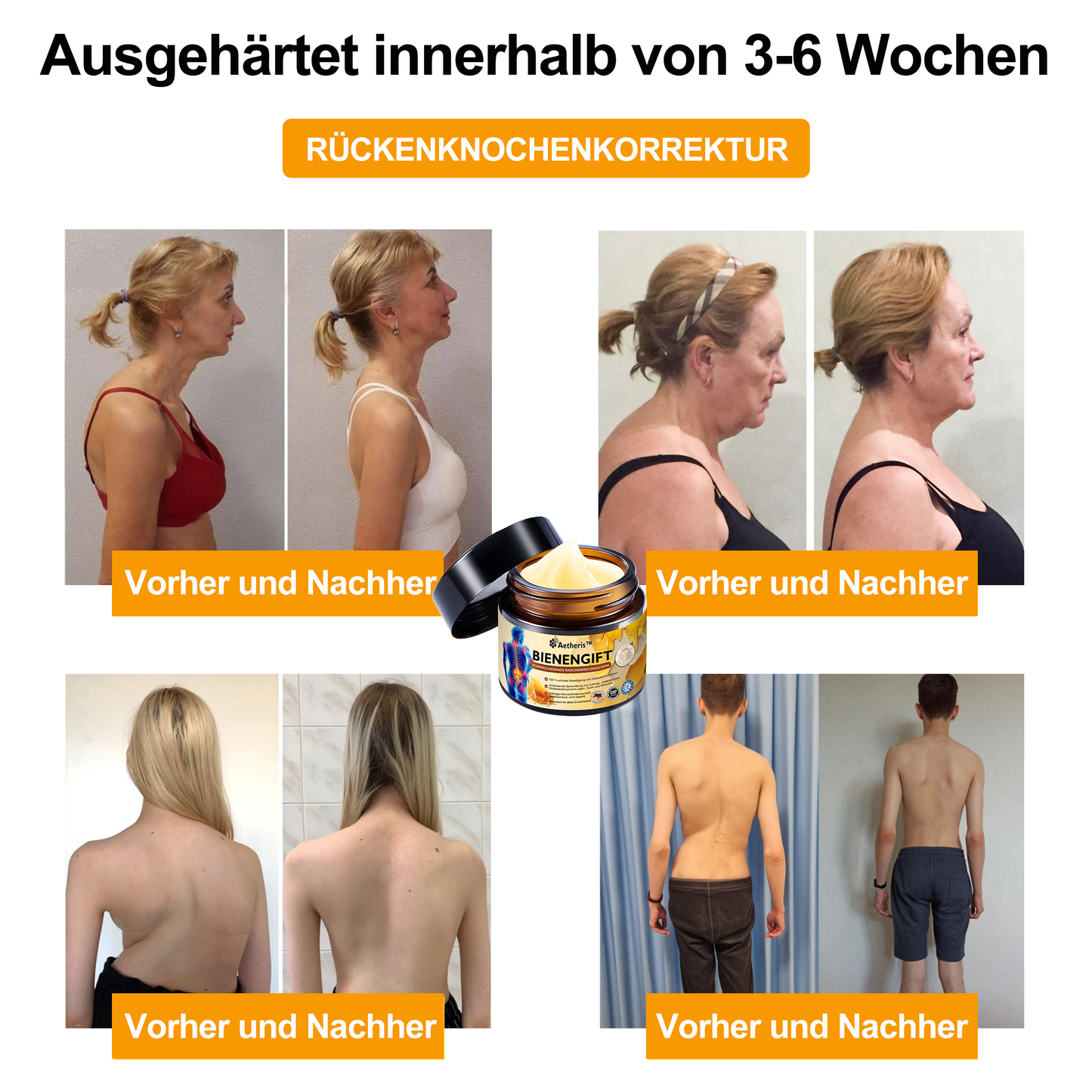 Offizieller Shop: 🔆🔆Aetheris™ Bienengift Sofortige Ultra Starke Schmerztherapie-Creme - (Bietet Schmerzlinderung bei Arthritis, Muskel-, Rücken-, Knie-, Schulter-, Hüft-, Handgelenks- und Handschmerzen)