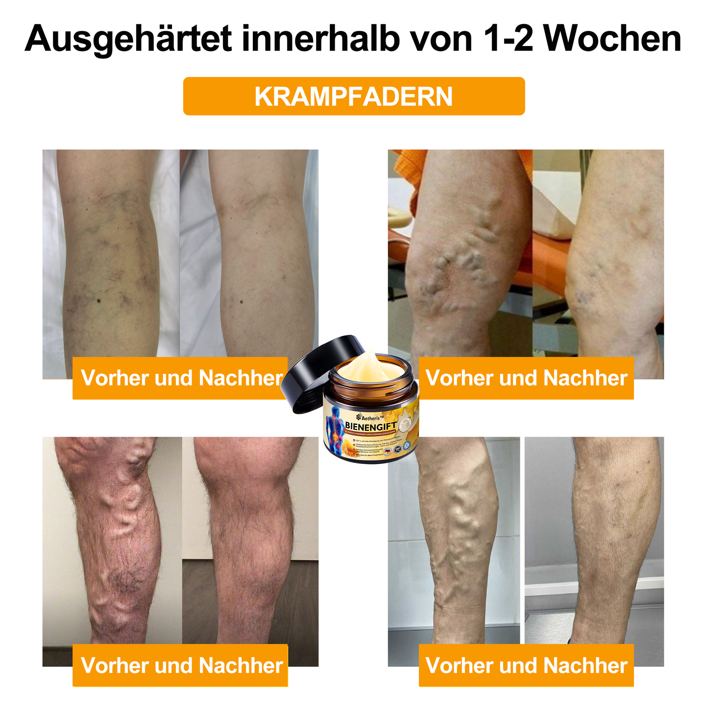 Offizieller Shop: 🔆🔆Aetheris™ Bienengift Sofortige Ultra Starke Schmerztherapie-Creme - (Bietet Schmerzlinderung bei Arthritis, Muskel-, Rücken-, Knie-, Schulter-, Hüft-, Handgelenks- und Handschmerzen)