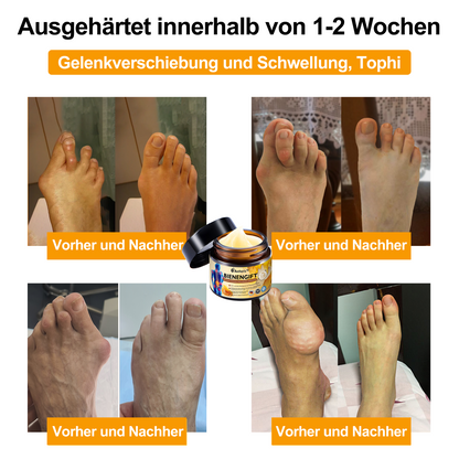 Offizieller Shop: 🔆🔆Aetheris™ Bienengift Sofortige Ultra Starke Schmerztherapie-Creme - (Bietet Schmerzlinderung bei Arthritis, Muskel-, Rücken-, Knie-, Schulter-, Hüft-, Handgelenks- und Handschmerzen)